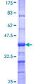 EXOC7 Protein - 12.5% SDS-PAGE Stained with Coomassie Blue.