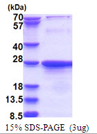 EXOSC1 / CSL4 Protein