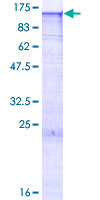 EXOSC10 Protein - 12.5% SDS-PAGE of human EXOSC10 stained with Coomassie Blue