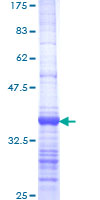 EXOSC2 / RRP4 Protein - 12.5% SDS-PAGE Stained with Coomassie Blue.