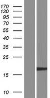 EXOSC3 Protein - Western validation with an anti-DDK antibody * L: Control HEK293 lysate R: Over-expression lysate