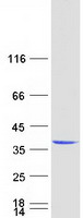 EXOSC3 Protein - Purified recombinant protein EXOSC3 was analyzed by SDS-PAGE gel and Coomassie Blue Staining