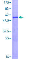 EXOSC4 / RRP41 Protein - 12.5% SDS-PAGE of human EXOSC4 stained with Coomassie Blue