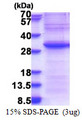 EXOSC4 / RRP41 Protein