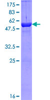 EXOSC5 Protein - 12.5% SDS-PAGE of human EXOSC5 stained with Coomassie Blue