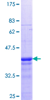 EXOSC5 Protein - 12.5% SDS-PAGE Stained with Coomassie Blue.