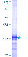 EXOSC6 Protein - 12.5% SDS-PAGE Stained with Coomassie Blue.