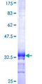 EXOSC6 Protein - 12.5% SDS-PAGE Stained with Coomassie Blue.