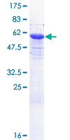 EXOSC7 Protein - 12.5% SDS-PAGE of human EXOSC7 stained with Coomassie Blue