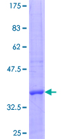 EXOSC7 Protein - 12.5% SDS-PAGE Stained with Coomassie Blue.