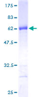 EXOSC8 Protein - 12.5% SDS-PAGE of human EXOSC8 stained with Coomassie Blue