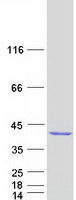 EXOSC8 Protein - Purified recombinant protein EXOSC8 was analyzed by SDS-PAGE gel and Coomassie Blue Staining