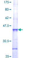 EXOSC9 / p5 Protein - 12.5% SDS-PAGE Stained with Coomassie Blue.