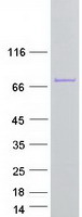 EXOSC9 / p5 Protein - Purified recombinant protein EXOSC9 was analyzed by SDS-PAGE gel and Coomassie Blue Staining