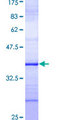 EXT1 Protein - 12.5% SDS-PAGE Stained with Coomassie Blue.
