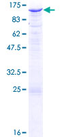 EXTL3 Protein - 12.5% SDS-PAGE of human EXTL3 stained with Coomassie Blue