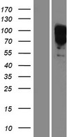 EYA1 Protein - Western validation with an anti-DDK antibody * L: Control HEK293 lysate R: Over-expression lysate