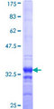 EYA1 Protein - 12.5% SDS-PAGE Stained with Coomassie Blue.