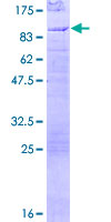 EYA2 Protein - 12.5% SDS-PAGE of human EYA2 stained with Coomassie Blue