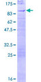 EYA2 Protein - 12.5% SDS-PAGE of human EYA2 stained with Coomassie Blue