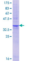 EYA3 Protein - 12.5% SDS-PAGE Stained with Coomassie Blue.