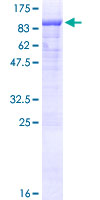 EYA4 Protein - 12.5% SDS-PAGE of human EYA4 stained with Coomassie Blue