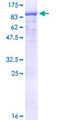 EYA4 Protein - 12.5% SDS-PAGE of human EYA4 stained with Coomassie Blue