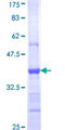 EYS Protein - 12.5% SDS-PAGE Stained with Coomassie Blue.