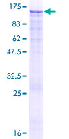 EZH2 Protein - 12.5% SDS-PAGE of human EZH2 stained with Coomassie Blue