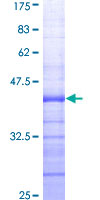EZH2 Protein - 12.5% SDS-PAGE Stained with Coomassie Blue.