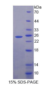EZH2 Protein - Recombinant Enhancer Of Zeste Homolog 1 By SDS-PAGE