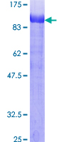 EZR / Ezrin Protein - 12.5% SDS-PAGE of human EZR stained with Coomassie Blue