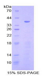 EZR / Ezrin Protein - Recombinant Cytovillin By SDS-PAGE