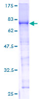 F10 / Factor X Protein - 12.5% SDS-PAGE of human F10 stained with Coomassie Blue