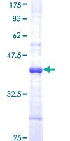 F11 / FXI / Factor XI Protein - 12.5% SDS-PAGE Stained with Coomassie Blue.