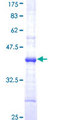 F11 / FXI / Factor XI Protein - 12.5% SDS-PAGE Stained with Coomassie Blue.