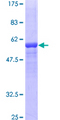 F12 / Factor XII Protein - 12.5% SDS-PAGE of human F12 stained with Coomassie Blue