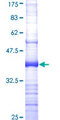 F12 / Factor XII Protein - 12.5% SDS-PAGE Stained with Coomassie Blue.