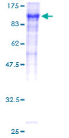 F13A1 / Factor XIIIa Protein - 12.5% SDS-PAGE of human F13A1 stained with Coomassie Blue