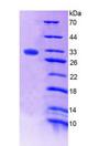 F13A1 / Factor XIIIa Protein - Recombinant Coagulation Factor XIII A1 Polypeptide By SDS-PAGE