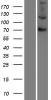 F13B / TGase Protein - Western validation with an anti-DDK antibody * L: Control HEK293 lysate R: Over-expression lysate