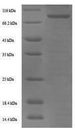 F2 / Prothrombin / Thrombin Protein - (Tris-Glycine gel) Discontinuous SDS-PAGE (reduced) with 5% enrichment gel and 15% separation gel.