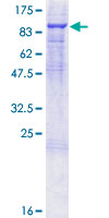 F2 / Prothrombin / Thrombin Protein - 12.5% SDS-PAGE of human F2 stained with Coomassie Blue