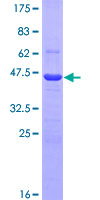 F2 / Prothrombin / Thrombin Protein - 12.5% SDS-PAGE Stained with Coomassie Blue.