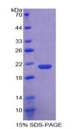 F2 / Prothrombin / Thrombin Protein - Recombinant Coagulation Factor II By SDS-PAGE