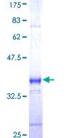 F2RL3 / PAR4 Protein - 12.5% SDS-PAGE Stained with Coomassie Blue.
