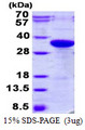 F3 / CD142 / Tissue factor Protein