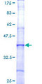 F5 / Factor Va Protein - 12.5% SDS-PAGE Stained with Coomassie Blue.
