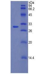 F5 / Factor Va Protein - Recombinant Coagulation Factor V By SDS-PAGE