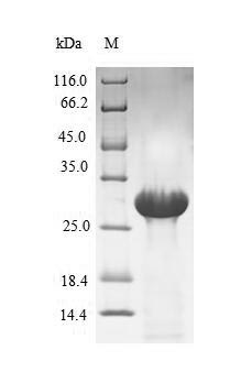 F7 / Factor VII Protein - (Tris-Glycine gel) Discontinuous SDS-PAGE (reduced) with 5% enrichment gel and 15% separation gel.
